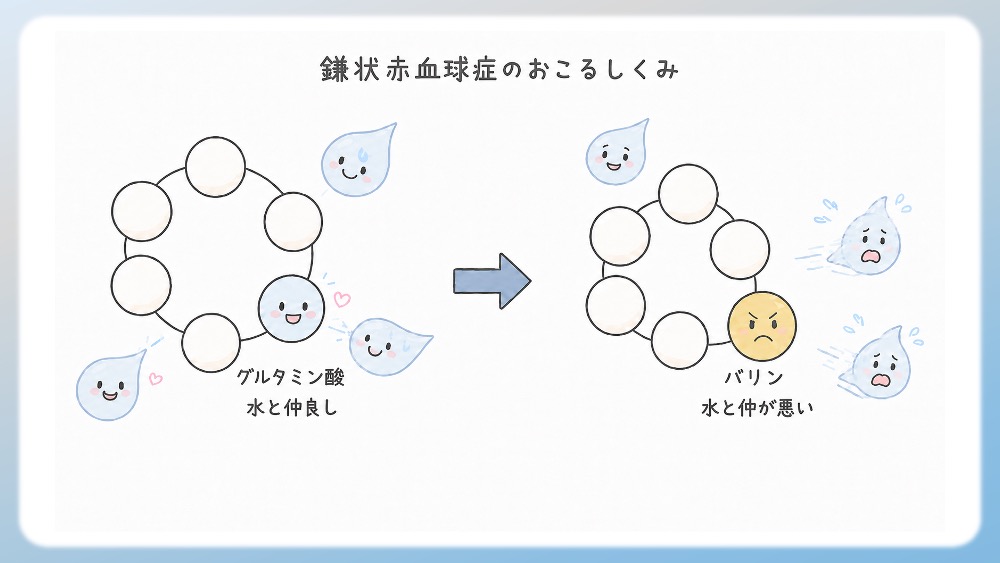 鎌状赤血球症のおこるしくみをわかりやすく説明したイラストです。鎌状瀬血球症では、ヘモグロビンのβ鎖という部分で、たった1つのアミノ酸が変わります。 本来その場所には、グルタミン酸 という、水となじみやすいアミノ酸があります。 ところが、このグルタミン酸が、バリン という水となじみにくいアミノ酸に変わります。 このことで周囲の水の反応が変わったり、構造が変形したりします。